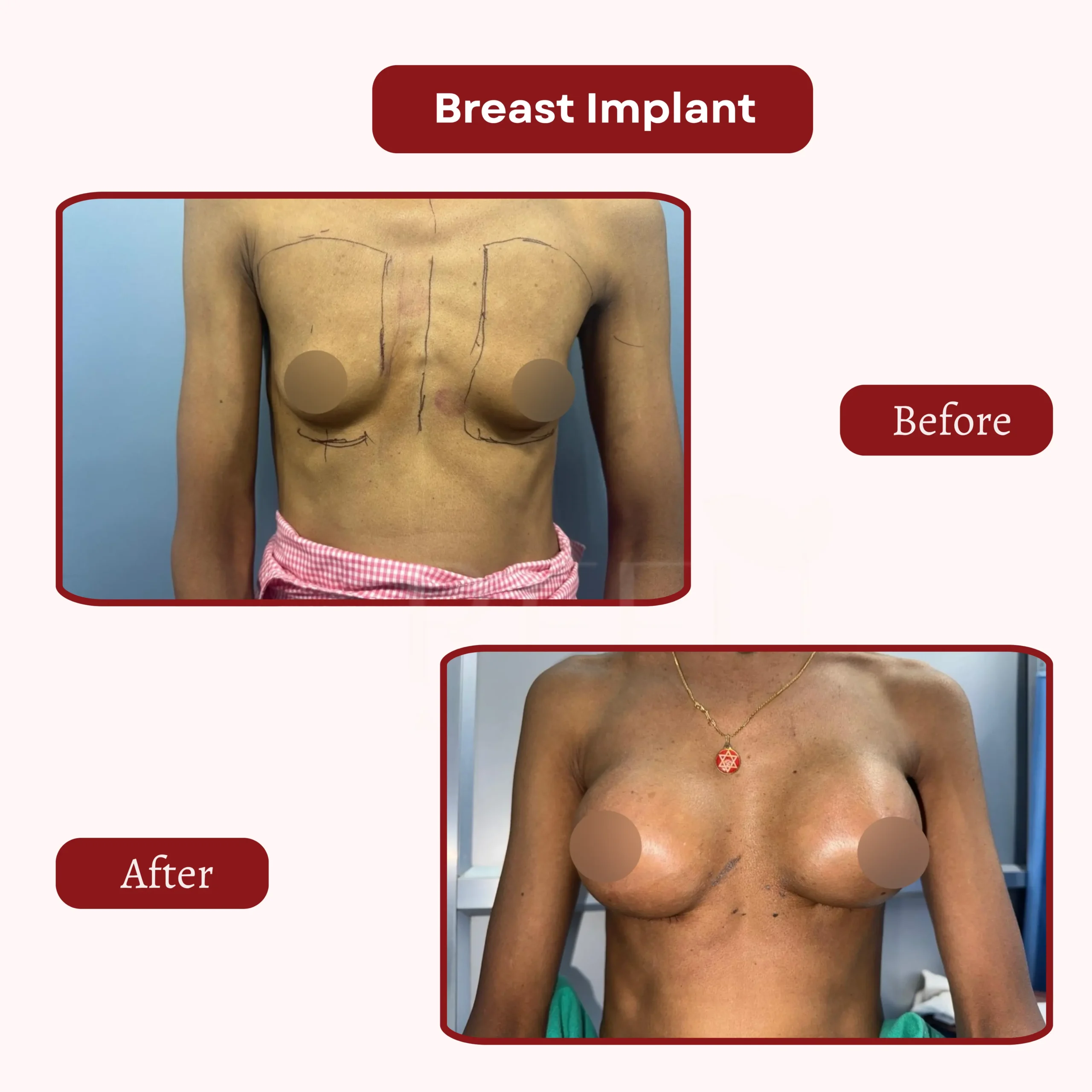 Before After photo Dr. aurobinda mohapatra (1)
